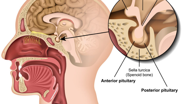 Pituitary and Its Disorders
